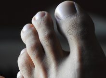 sharp pain in big toe joint