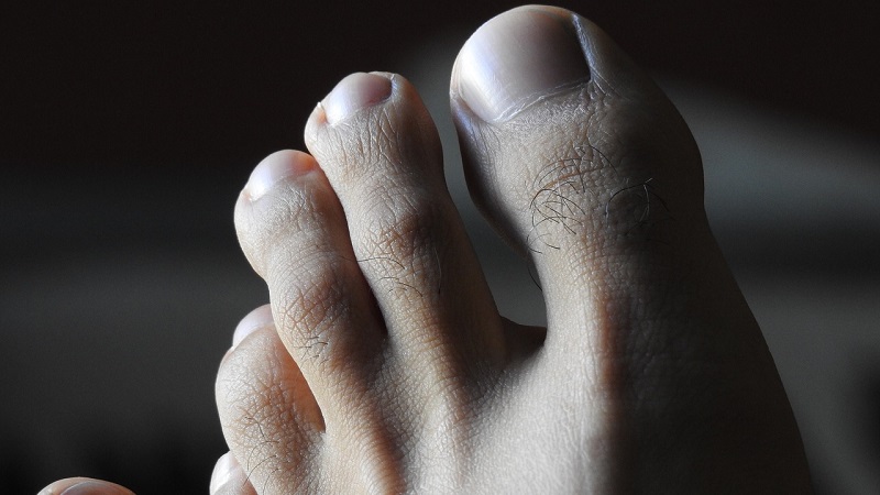 Why Do You Have Sharp Pain In The Big Toe Joint